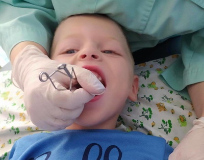 Логопедичні зонди для дітей з інвалідністю - фото